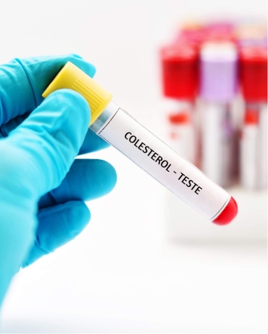 COLESTEROL